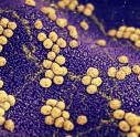 Colony of Staphylococcus aureus bacteria causing skin infection