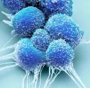Prostate cancer cells