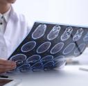 Doctor looking at brain scans in MS