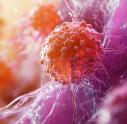 Representation of Non-Hodgkin Lymphoma