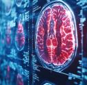 Representation of a brain scan